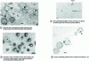 Figure 10 - Adulterated honeys (untreated) (Mph)