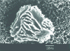 Figure 2 - Cyatheaceae spore: ridged distal surface (SEM)