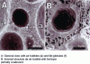 Figure 2 - Microphotographs of whipped cream [1]