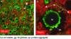 Figure 6 - Confocal microphotographs of a milky foam [1].