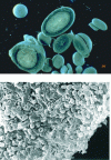 Figure 2 - Binocular loupe and electron microscope view of granular sludge