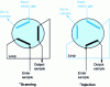 Figure 17 - Diagram of a gas valve (from [P 1 485])