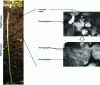 Figure 1 - Vertical and structural variability of the soil matrix (photo credit: L. Ranjard, INRA)