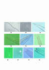 Figure 8 - Bacterivorous and fungivorous soil nematodes: (a) Chronogaster sp., (b) Tylocephalus sp., (c) Aphelenchoides sp., (d) Acrobeles mariannae, (e) Acrobeloides sp., (f) Teratocephalus costatus, (g) Wilsonema sp., (h) Plectus armatus, (i) Panagrolaimus paetzoldi and (j) Mononchoides striatus(@Roel Wagenaar, Wageningen, NIOO KNAW)