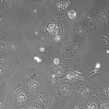 Figure 7 - Microglial cells recorded by phase-contrast microscopy