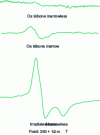 Figure 4 - EPR spectra of bones