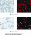 Figure 10 - Light microscopy photographs of eicosan capsules loaded with fluorescent dye