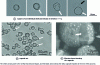 Figure 8 - Light microscopy and scanning electron microscopy images of induced release