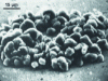 Figure 10 - Scanning electron microscope view of a magnetic dot revealed by magnetic toner particles