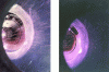 Figure 6 - Photographs taken during the operation using two shutter speeds (source: TPM)