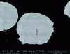 Figure 9 - Micrographic section with solidification porosity on TA6V