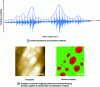 Figure 3 - A) Method of constructing an infrared spectrum B) Example of chemical mapping obtained on filament-forming bacteria capable of storing high concentrations of lipids. On the left, the topography representing a cluster of bacterial filaments. On the right, the infrared image corresponding to absorption at 1,740 cm-1