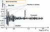 Figure 2 - Waveform (FO) of an EA burst and main parameters measured in real time