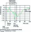 Figure 11 - Deceleration curve