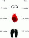 Figure 28 - Effect of gravity on blood pressure in the eyes, feet and heart,
using a reference blood pressure at the heart of 100 mmHg (doc. LEFEBURE P.) [8]