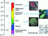 Figure 8 - Size distribution of micro-organisms and nanoparticles