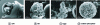 Figure 11 - Images of different particles obtained by spray drying [2].