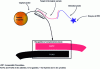 Figure 12 - Principle of a "nucleic probe" target capture and detection assay for gene diagnostics based on magnetic particles