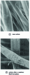 Figure 9 - Scanning microscope photos of cotton fibers