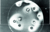 Figure 12 - Depletion of solute concentration around crystals (phase-contrast microscopy: clear phase = low-concentration phase) 