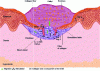 Figure 4 - Proliferation phase