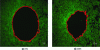 Figure 5 - Fluorescence demonstration and image analysis of the migration/proliferation of normal human epidermal keratinocytes (NHEK) in the area of an artificial wound in 24 h (© Société Bioalternatives)