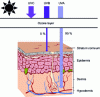 Figure 5 - Effects of UV radiation on human skin