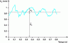 Figure 11 - Speed at a given point: change as a function of time