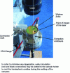 Figure 18 - Laser extraction chamber