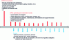 Figure 4 - Temporality of expenditure over the economic life of a project (excluding deconstruction and reinvestment)