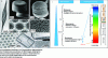 Figure 1 - a-h) Various radiolar exoskeleton structures observed by scanning electron microscopy (SEM) and optical microscopy and i) schematic diagram of mass and photon transport across the porosity scales encountered. Porosity is classified here according to the IUPAC (International Union of Pure and Applied Chemistry) nomenclature [7].