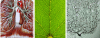 Figure 3 - Some examples of self-similar hierarchical connections observed in nature: the lung network on the left, a leaf vein in the center and a neural network on the right.