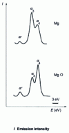 Figure 4 - Satellite emissions of , in metal and Mg O oxide (from [38])