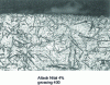 Figure 46 - Carbonitrided layer: martensitic structure and residual austenite