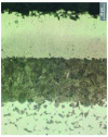 Figure 23 - Nitrocarburizing at 680°C: thin layer of oxides and porosities on extreme surface, 35-40 µm thick ε-combination layer and 40 µm thick nitrogen austenite layer transformed into lower bainite by tempering at 350°C (Corr-I-Dur BODYCOTE).