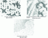 Figure 1 - Homogenization of a CuSn9P bronze (magnification 500) (from CICLA instructions)