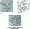 Figure 28 - Martensitic quenching and tempering of CuAl10Ni5Fe5 cupro-aluminum (doc. CICLA)