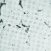 Figure 3 - Magnesium-silver-zirconium-rare earth alloys after solution treatment and tempering (x 420)