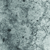 Figure 4 - Incomplete homogenization of MgAl9Zn1 alloy (x 110)