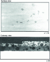 Figure 2 - Nail clippings