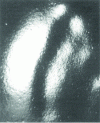 Figure 4 - Enamel flow