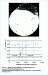 Figure 9 - Example of Nd:YAG laser deposition with dilution