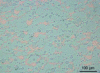 Figure 23 - Optical cross-sectional image of a cold spray composite deposit with 316L steel matrix (gray), Ni700 (11% vol., dark gray) and copper (15% vol., pink) (doc. MINES ParisTech, R. Maestracci)