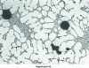 Figure 8 - Gassing porosity in a sand-cast sodium-modified A-S7G03 alloy