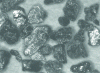 Figure 5 - Crushed pieces of chromium corundum