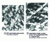 Figure 6 - Dislocation microstructures in plane-compression-deformed aluminum (transmission electron microscopy, TEM, on longitudinal sections)