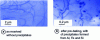 Figure 19 - TEM micrographs of 1050 aluminum alloy [21].