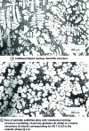 Figure 1 - Microstructures of alloys obtained by traditional liquid casting, or partially solidified metal casting with mechanical stirring