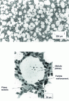 Figure 13 - Microstructure at two different magnifications of an AS 7 G 06 composite, reinforced with 20% by volume SiC particles, held for 40 min at 585°C.