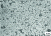 Figure 14 - Micrographic structure of a double-phase steel [1]